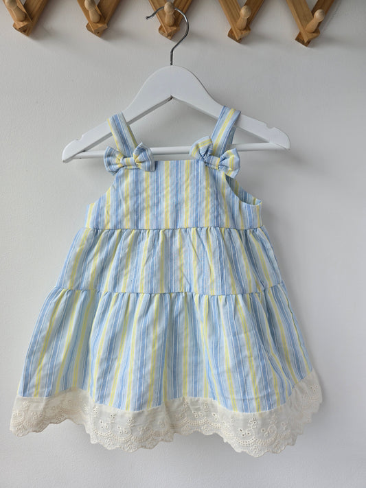 Lemon striped summer dress